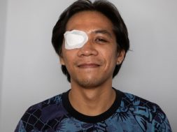 Armon-from-the-Phillippines-after-catarct-surgery.jpg